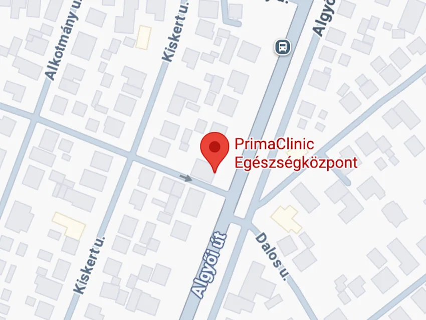 Útvonaltervezés: PrimaClinic Egészségközpont térkép, Szeged, Algyői út 24.